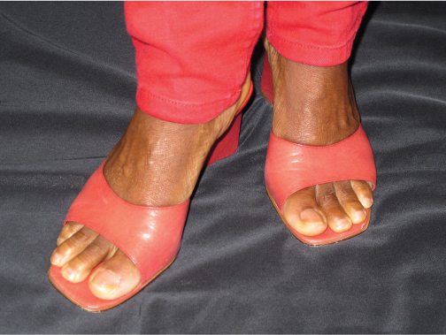 shoe fashion